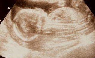 济南助孕机构哪家强？这份排名清单必看，别让这家错过！